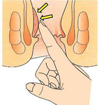 内痔发作是种什么感受？