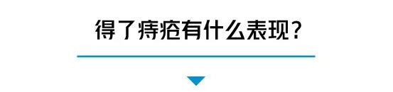 听说你“少年得痔”，请问你得的是什么痔？得痔疮的表现有哪些？