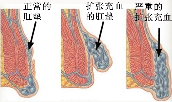 屁股背后那些不可告人的秘密！看完我菊花一紧